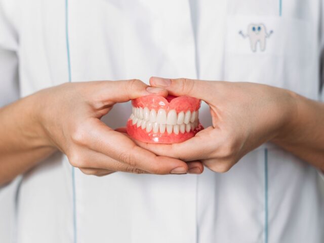 Complete Dentures