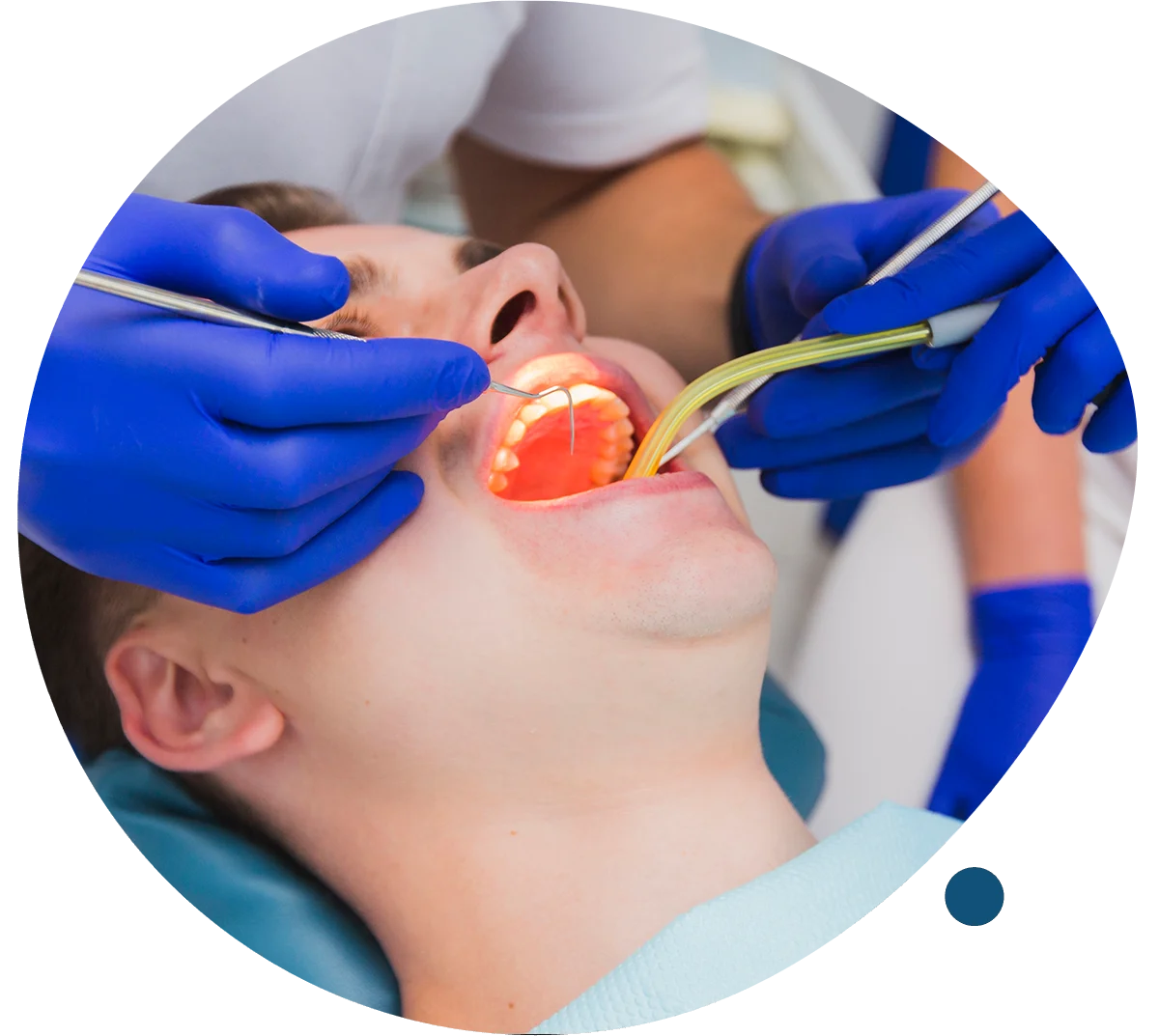 Laser Gum Treatments & Depigmentation