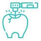 https://www.inwhitedental.in/wp-content/uploads/2024/07/Laser-Treatments.png
