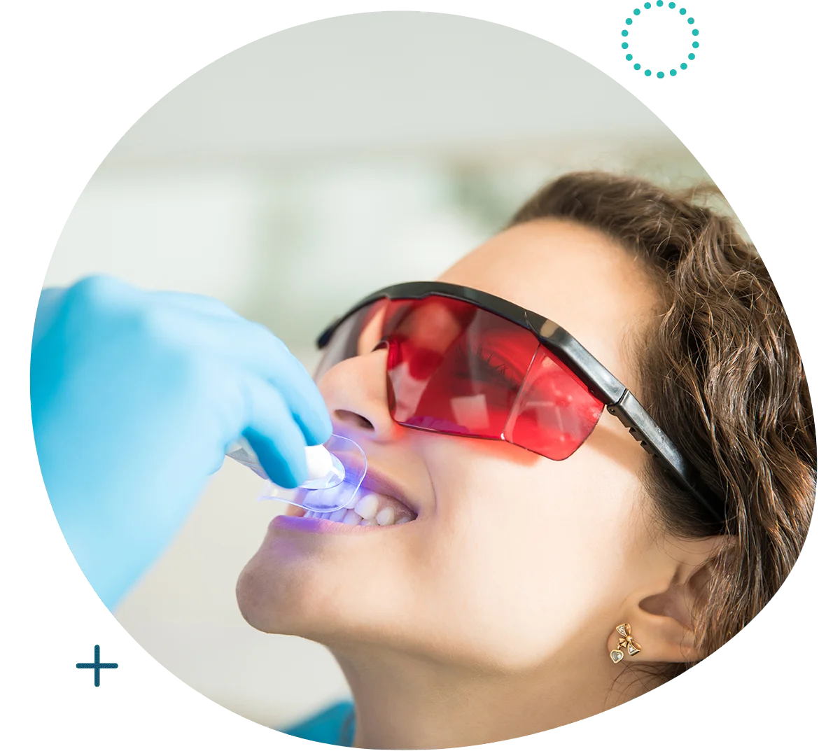Veneers & Laser Whitening