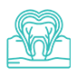 https://www.inwhitedental.in/wp-content/uploads/2024/07/Root-Canals.png