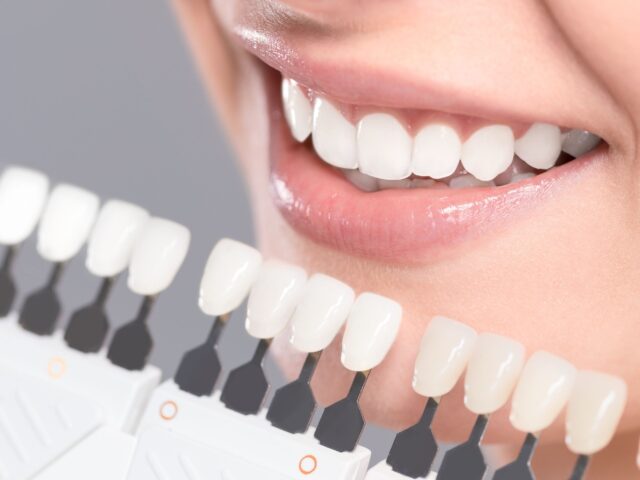 Zirconia Crowns