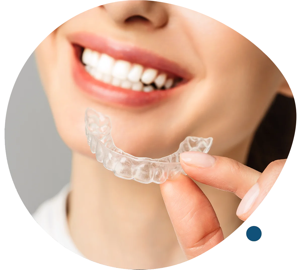 Invisible Aligners