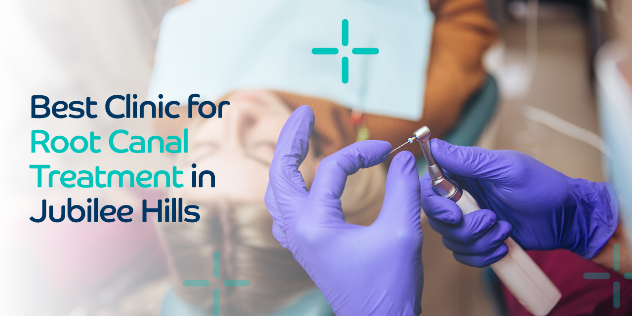 Best Clinic for Root Canal Treatment in Jubilee Hills