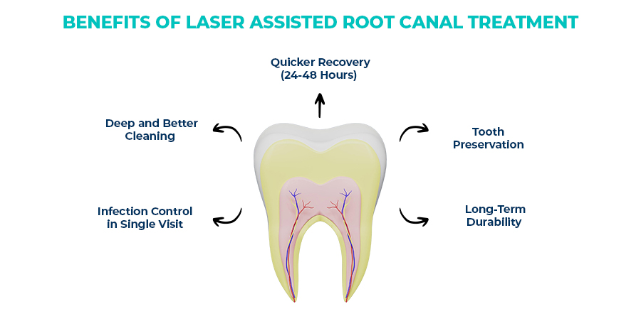 benefits of laser assisted root canal treatment 