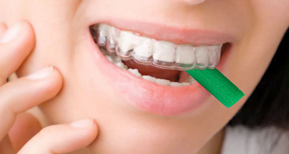 Invisible Aligner Chewies: Purpose, Precautions, How to Use Them