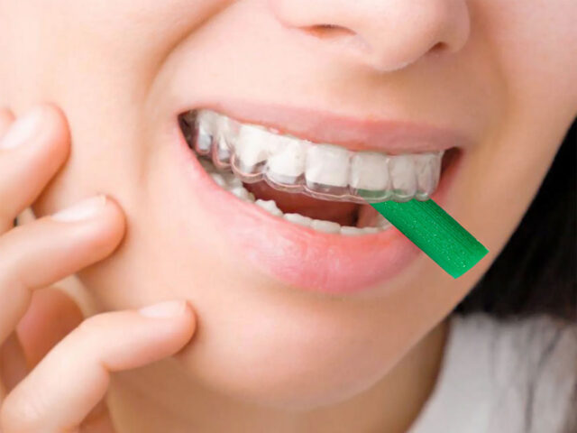 invisible aligner chewies