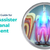 root canal is performed with laser dentistry